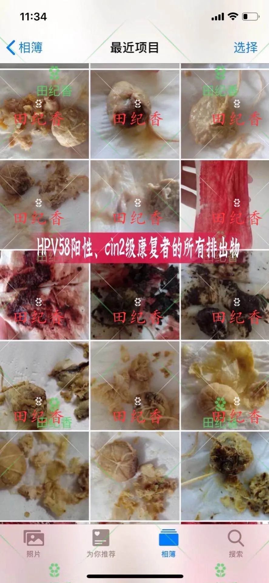 感染了HPV，癌前病变怎么办？