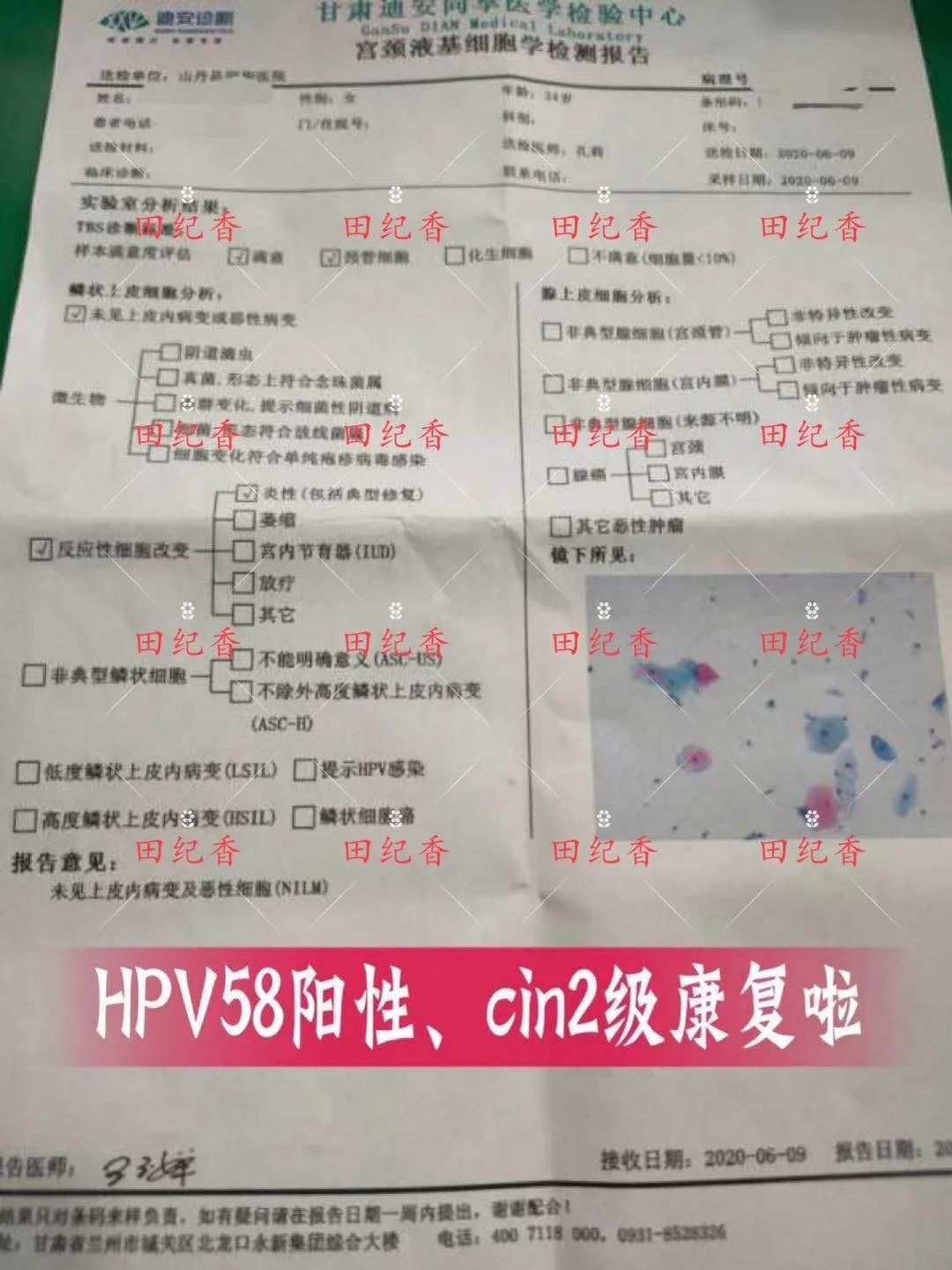 感染了HPV，癌前病变怎么办？