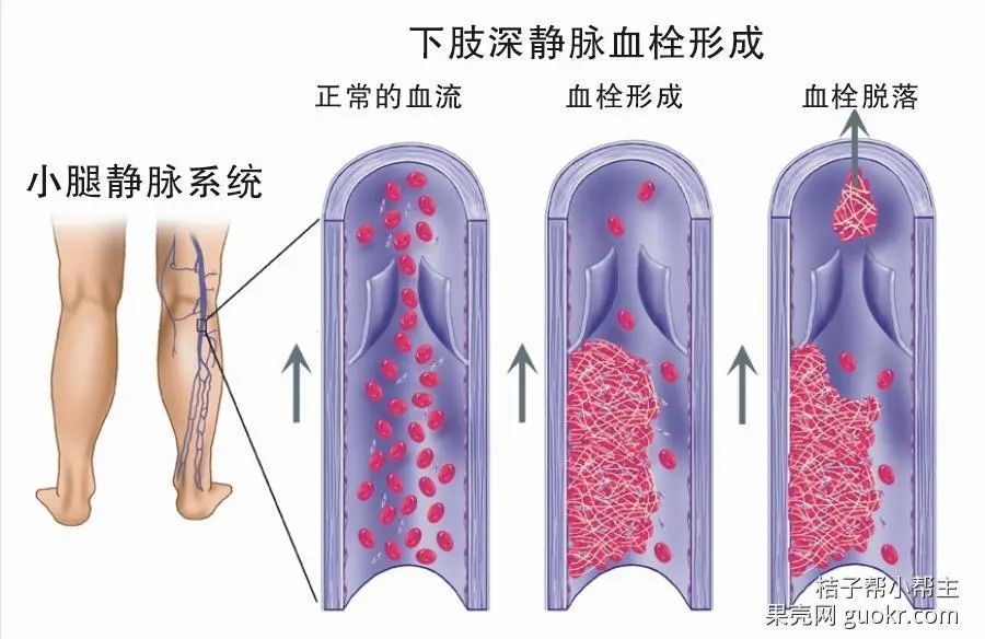 懷孕需要改變什麼—（9）飛機能坐嗎 親子 第2張