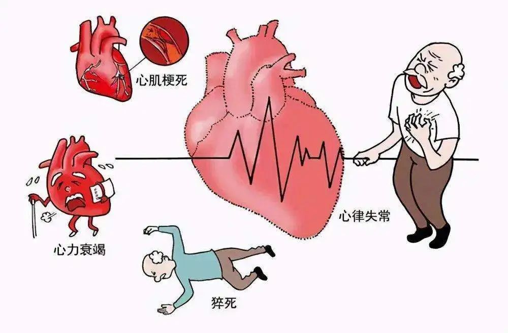 心肌梗塞卡通图片