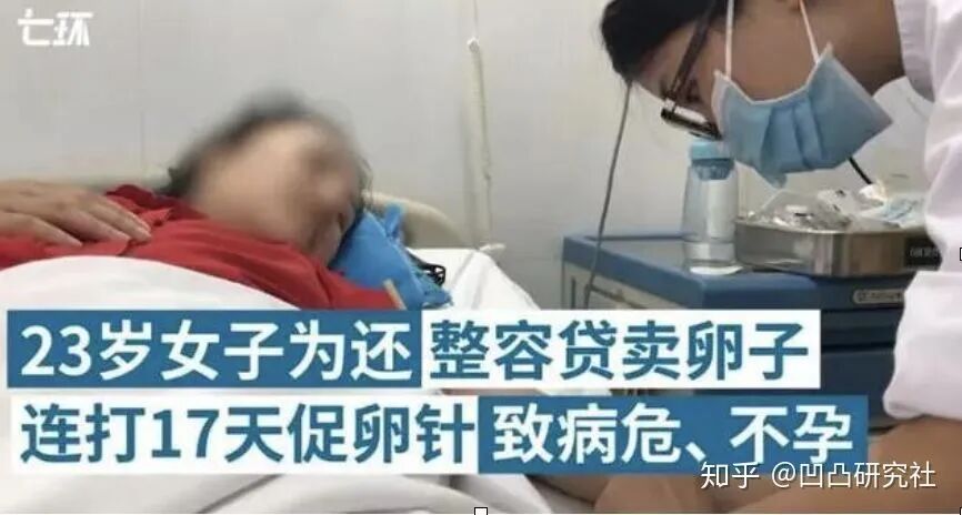 取卵针长什么样「不打麻药，穿刺下身，一次5万」没有性生活的我，卖了17颗卵_https://www.jmylbn.com_新闻资讯_第5张