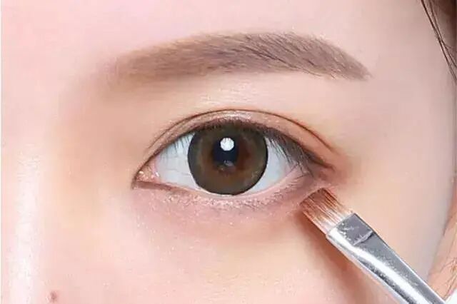 双眼皮手术深圳哪家医院效果好_深圳哪家做双眼皮手术好_深圳切双眼皮