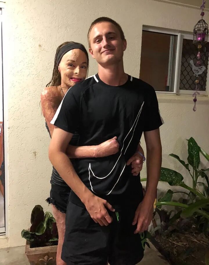 澳洲选美小姐为救儿子逃离火海全身85%烧伤！拍全裸写真鼓励他人积极生活（组图） - 9