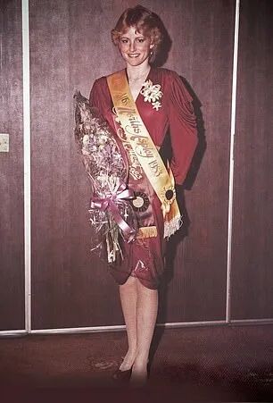 澳洲选美小姐为救儿子逃离火海全身85%烧伤！拍全裸写真鼓励他人积极生活（组图） - 2