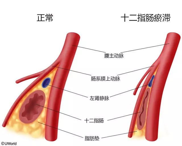 教減肥的那麼多，可是我想增肥怎麼辦？ 健康 第6張