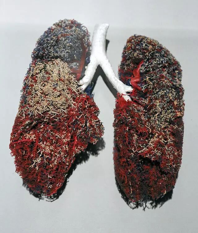 图片[4]-听说戒烟会长胖，那是先减肥还是先戒烟呢？-不戒烟