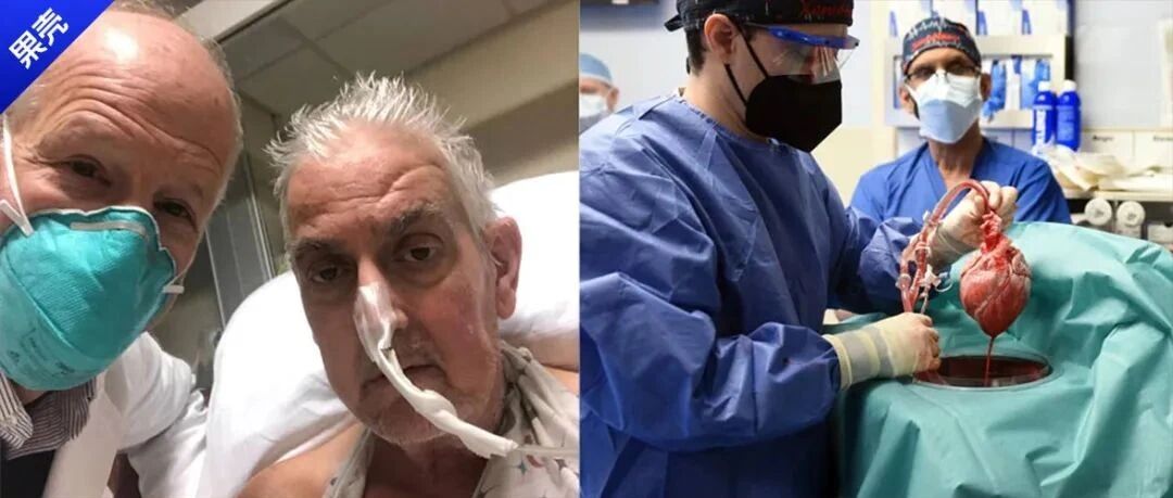 全球首例！为了活下去他移植了猪的心脏