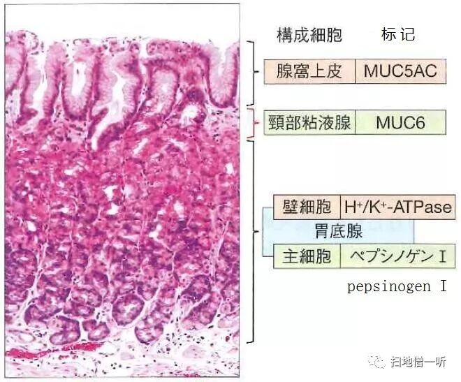 医学美图 胃 肠化の免疫组化基础 扫地僧一听 微信公众号文章阅读 Wemp