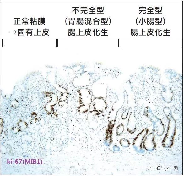 医学美图 胃 肠化の免疫组化基础 扫地僧一听 微信公众号文章阅读 Wemp