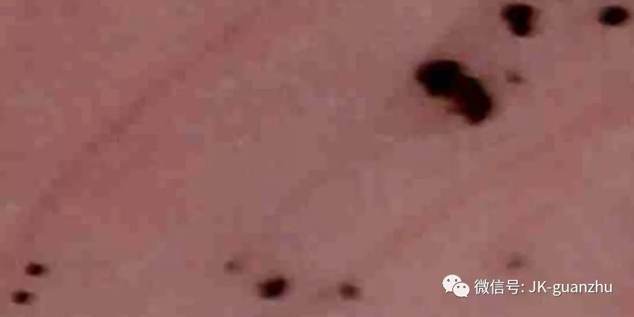 什么是黑色素瘤