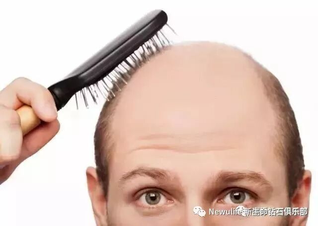 【新生命HGH凝胶】脱发时代，你的头发到底值多少钱！