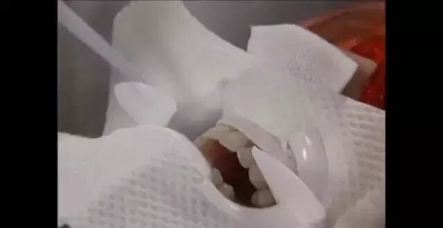 为什么牙医不用开口器刷屏朋友圈的冷光美牙仪，背后隐藏的风险你了解吗？_https://www.jmylbn.com_新闻资讯_第13张