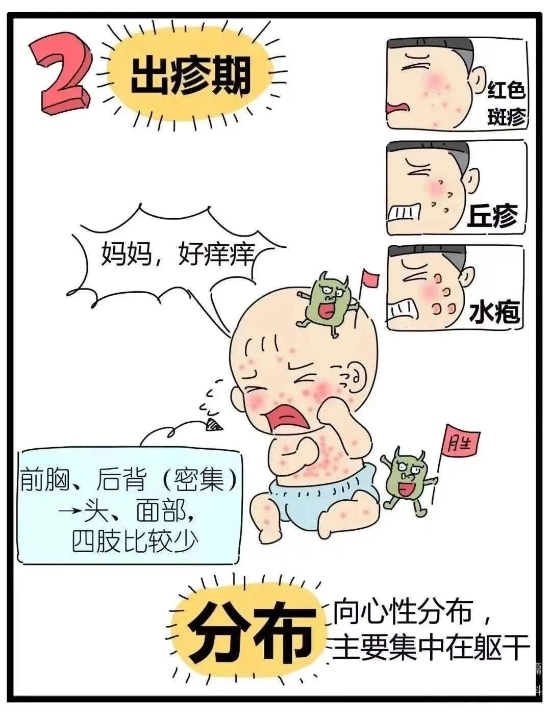 1～2天后疱疹从中心开始干枯,结痂,红晕消失.