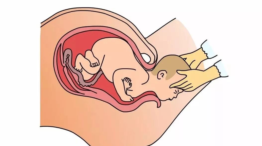 顺产都要侧切吗？其实你不必挨这一刀