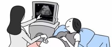 胎心监护，产科医生一般不会告诉你这么多