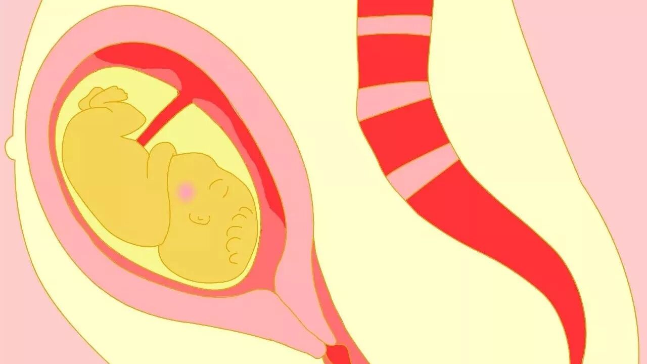 常说的“开十指”，原来是这么一回事，90%的妈妈都理解错了