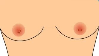 从孕期到产后，这才是保护乳房的最好手段