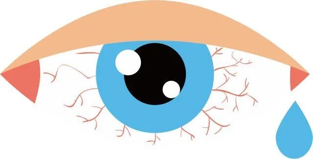 古法经络|如何对抗眼干涩眼疲劳？