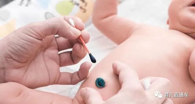 剪脐带用什么剪刀新生儿脐带“咔嚓”一剪刀，妈妈疼还是宝宝疼？答案你可能想不到_https://www.jmylbn.com_新闻资讯_第4张