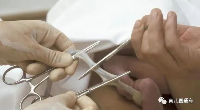 剪脐带用什么剪刀新生儿脐带“咔嚓”一剪刀，妈妈疼还是宝宝疼？答案你可能想不到_https://www.jmylbn.com_新闻资讯_第3张