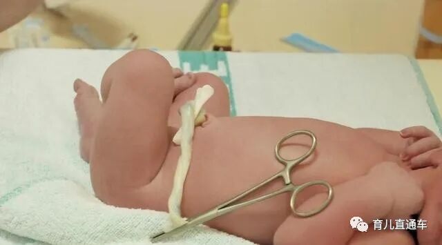 剪脐带用什么剪刀新生儿脐带“咔嚓”一剪刀，妈妈疼还是宝宝疼？答案你可能想不到_https://www.jmylbn.com_新闻资讯_第6张