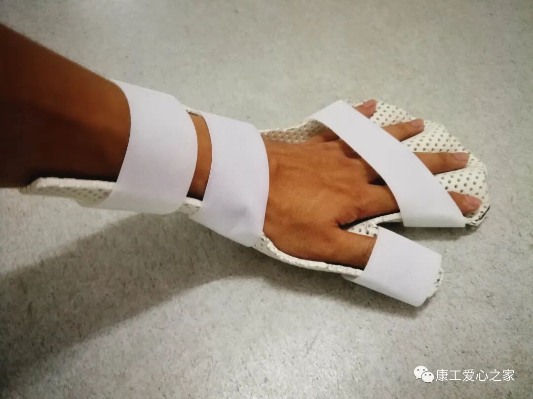 下肢关节康复器怎么用康复科普｜腕手矫形器在工伤康复中的应用_https://www.jmylbn.com_新闻资讯_第6张