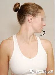 什么是费城颈托康复科普｜颈托在工伤康复中的应用_https://www.jmylbn.com_新闻资讯_第19张