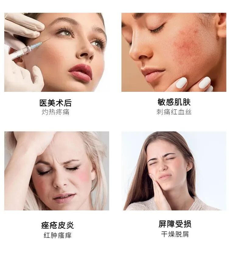 可吸收医用膜是什么医用面膜是坑吗？它和普通面膜有什么区别？_https://www.jmylbn.com_新闻资讯_第6张