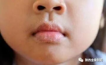 秋分后注意四点可以让孩子少生病