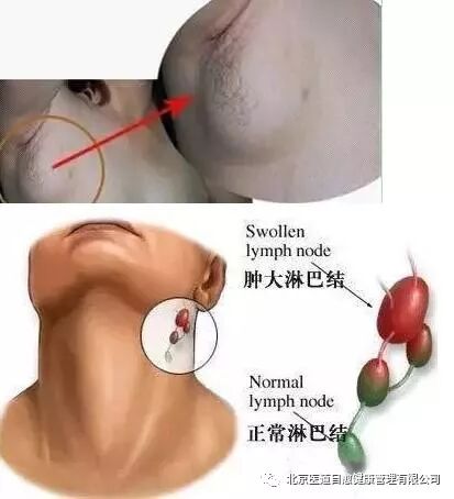 身体内的湿气是什么