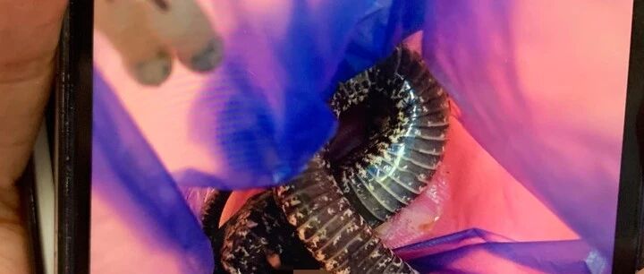 蛇咬了狗，狗咬了人，蛇狗都已死，浙江一男子紧急求医：我该怎么办？