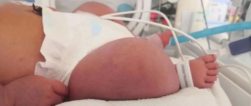 二胎13斤6两!头胎11斤4两!