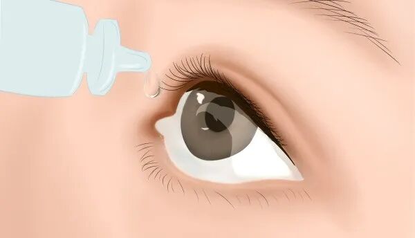 12种眼科常用药的注意事项