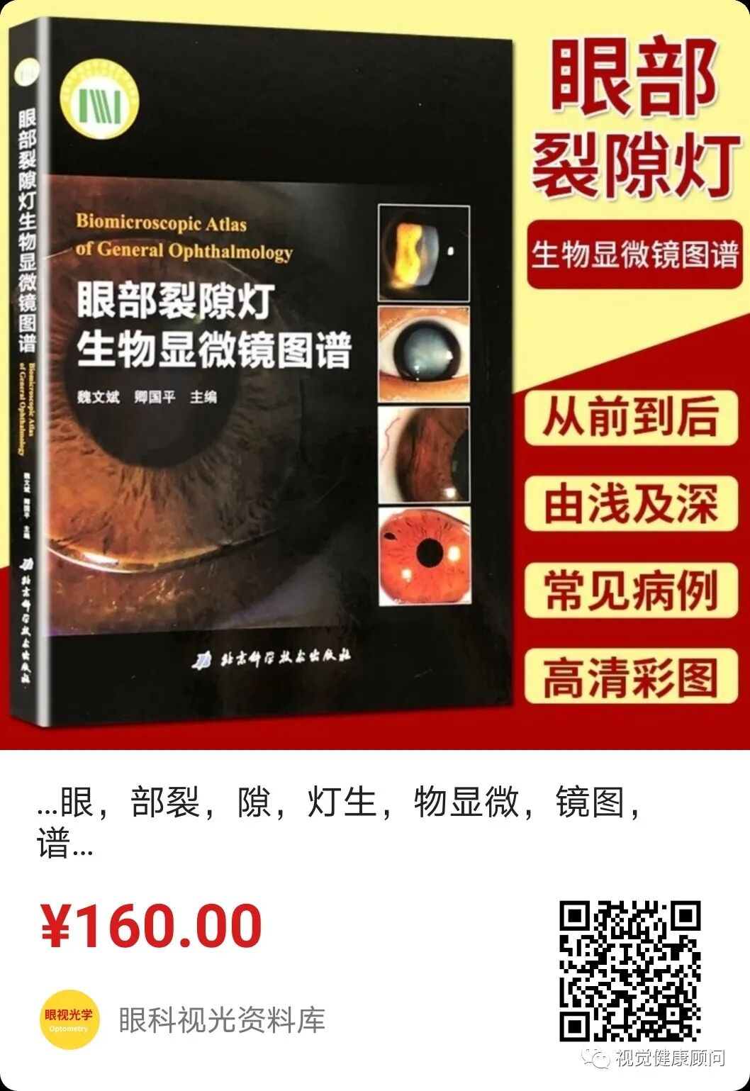 什么是裂隙灯验光检查裂隙灯检查什么？_https://www.jmylbn.com_新闻资讯_第11张