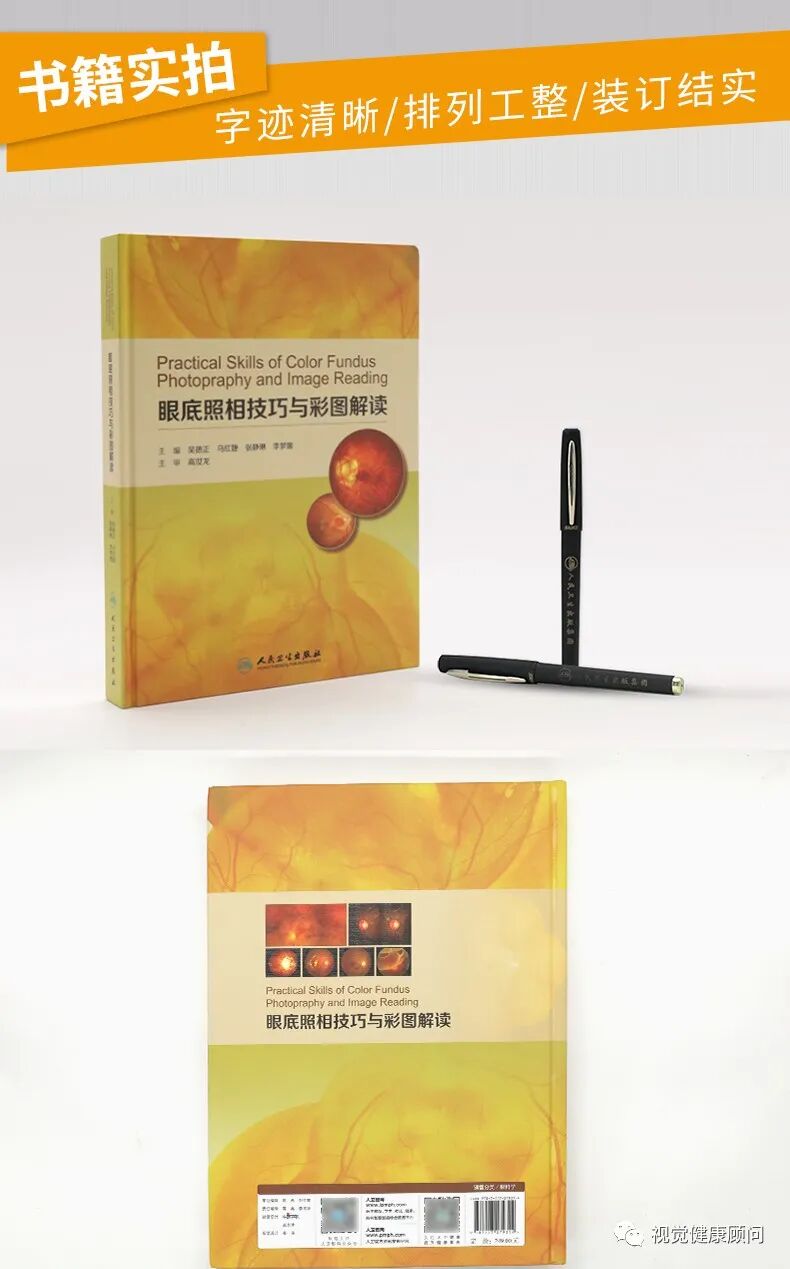 彩色眼底照相查什么一张眼底照片，可筛查出80%的眼病_https://www.jmylbn.com_新闻资讯_第6张