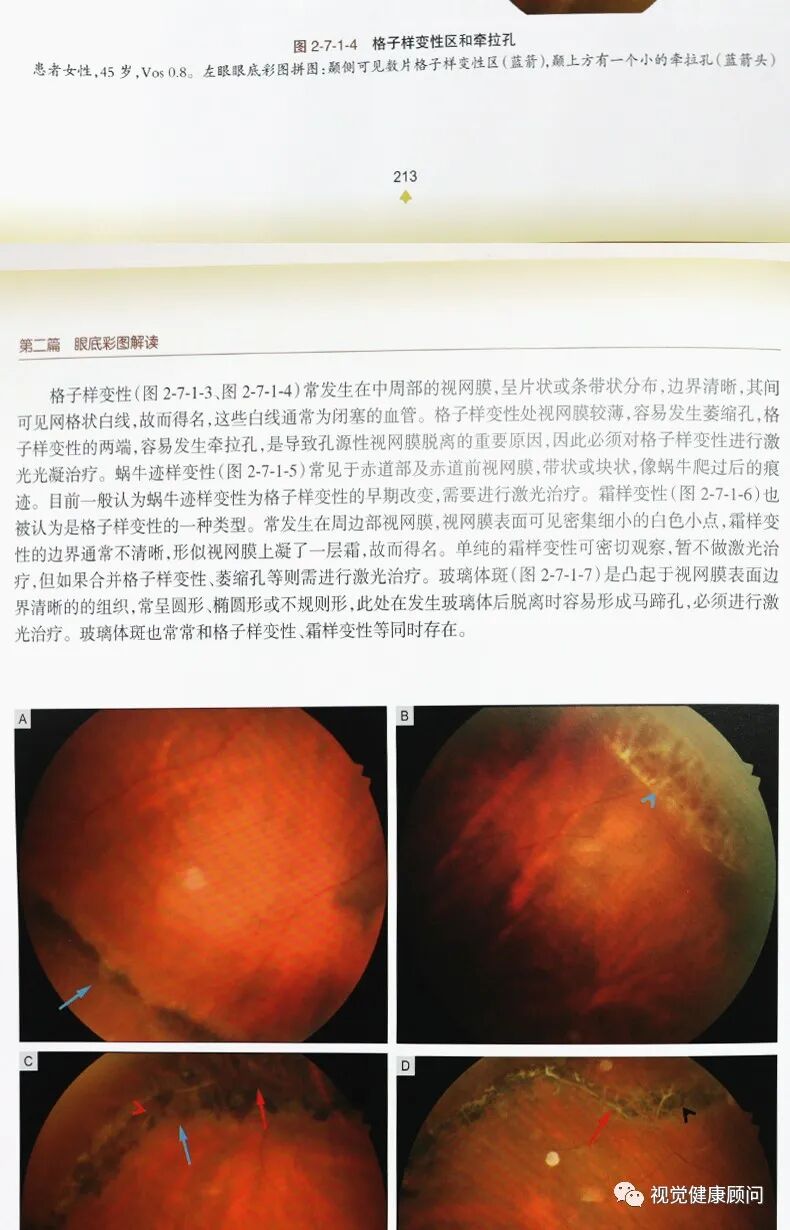 眼底照相能检查出什么眼底检查方式的差别_https://www.jmylbn.com_新闻资讯_第13张