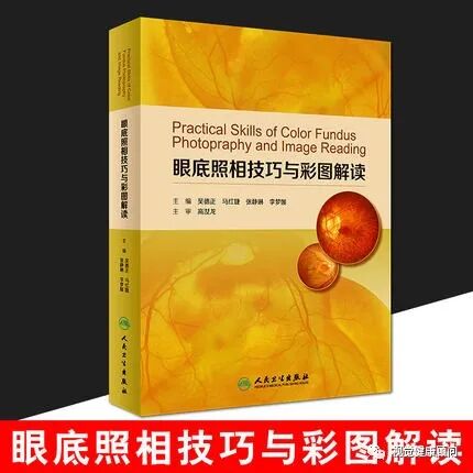 眼底照相能检查出什么眼底检查方式的差别_https://www.jmylbn.com_新闻资讯_第8张