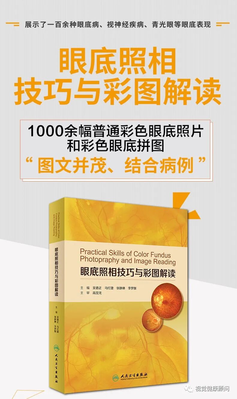 眼底照相能检查出什么眼底检查方式的差别_https://www.jmylbn.com_新闻资讯_第11张