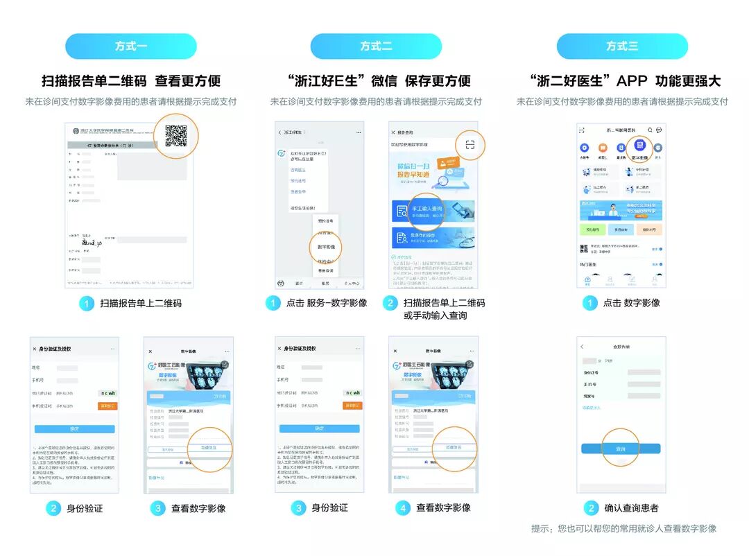为什么x光片用胶片浙大二院上线数字影像服务— X光片“装进”手机里_https://www.jmylbn.com_新闻资讯_第8张