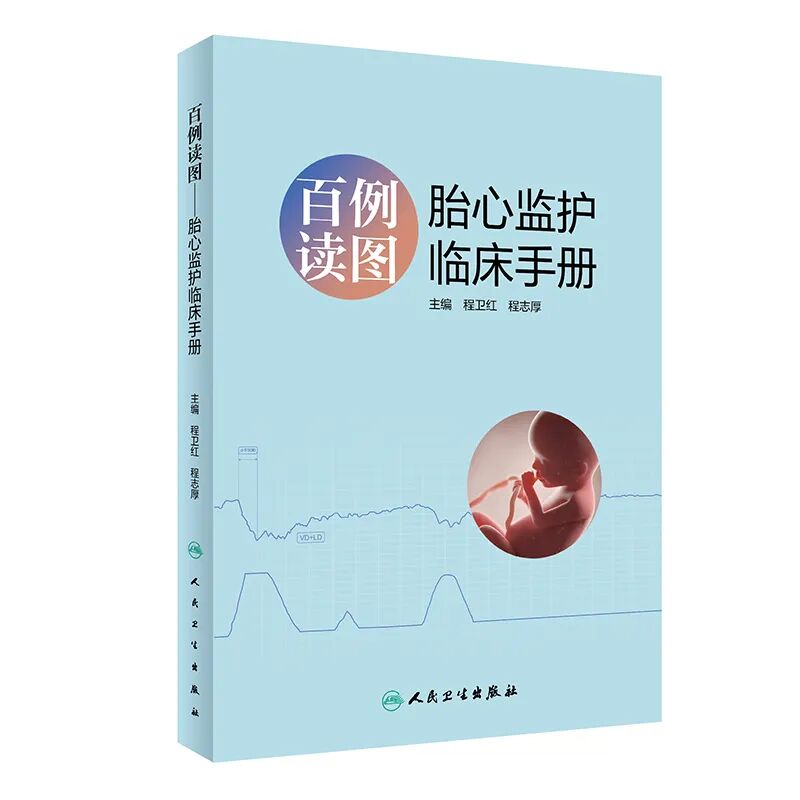 胎心监护vd是什么意思胎心监护如何评估？变异减少时又该如何判读？附病例、图表详细解读＞_https://www.jmylbn.com_新闻资讯_第17张