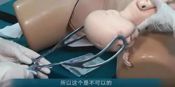 kielland产钳怎么翻译分步骤讲解低位产钳术，一文全部掌握！（内有福利）_https://www.jmylbn.com_新闻资讯_第4张