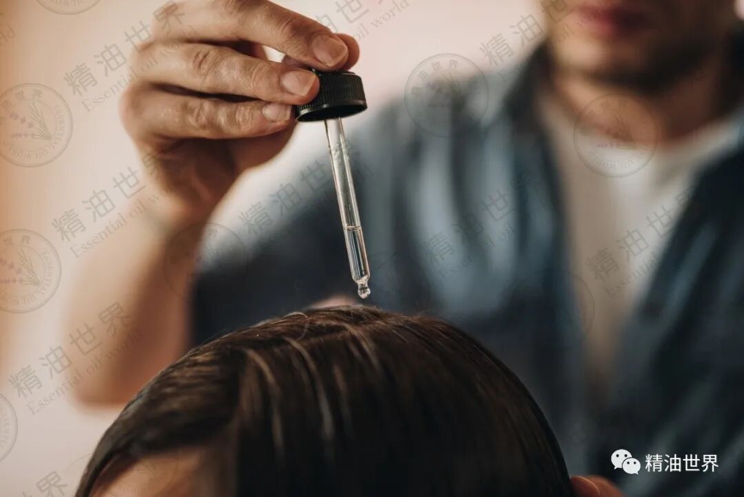 夏季头皮爱出油，快用精油这样调理！