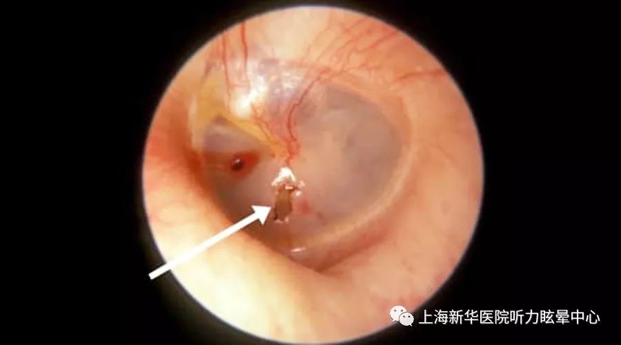 肉眼能看到耳膜吗图片