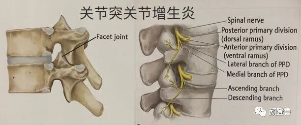 6,骶髂关节炎5,腰背肌筋膜炎4,关节突增生性炎3,椎间盘源性疼痛2,退变