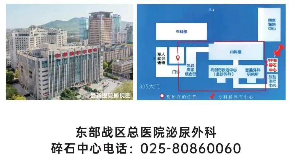 体外碎石b超怎么定位结石患者福音！德国多尼尔碎石机落户东部战区总医院_https://www.jmylbn.com_新闻资讯_第38张