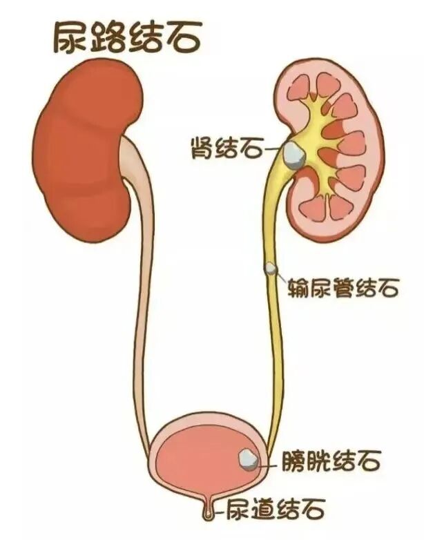 体外碎石b超怎么定位结石患者福音！德国多尼尔碎石机落户东部战区总医院_https://www.jmylbn.com_新闻资讯_第13张