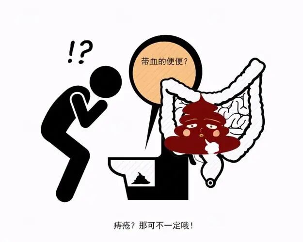 AED怎么自检女性做痔疮手术的危害？花一分钟自检一下,还是很准的!_https://www.jmylbn.com_新闻资讯_第4张