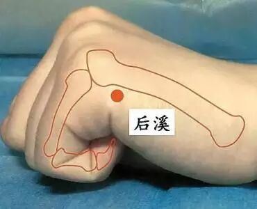 急性腰扭伤怎么办,教你如何正确处理