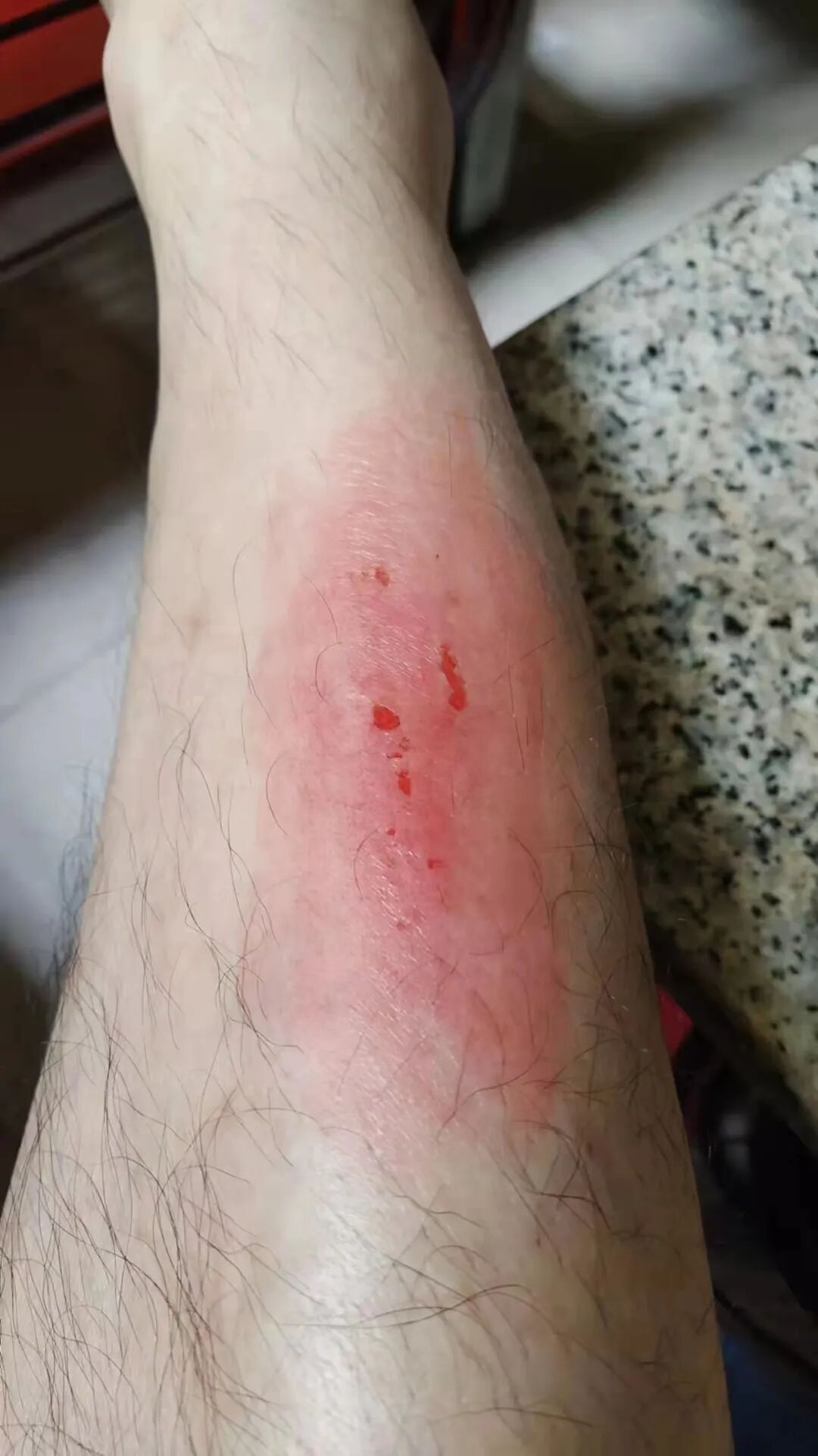 我为群众办实事为深夜下水勇救轻生女而受伤的饶平辅警点赞