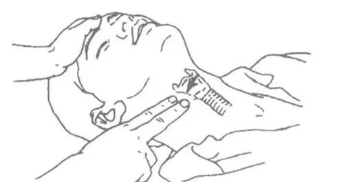 cpr按压板怎么用防疫不停学—心肺复苏(CPR)操作流程_https://www.jmylbn.com_新闻资讯_第7张